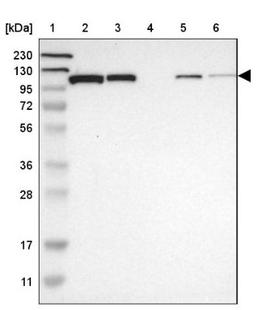 Western Blot: HspA4 Antibody [NBP1-81696] - Lane 1: Marker [kDa] 230, 130, 95, 72, 56, 36, 28, 17, 11<br/>Lane 2: Human cell line RT-4<br/>Lane 3: Human cell line U-251MG sp<br/>Lane 4: Human plasma (IgG/HSA depleted)<br/>Lane 5: Human liver tissue<br/>Lane 6: Human tonsil tissue