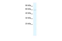 Antibody used in WB on Human Jurkat 2.5 ug/ml.