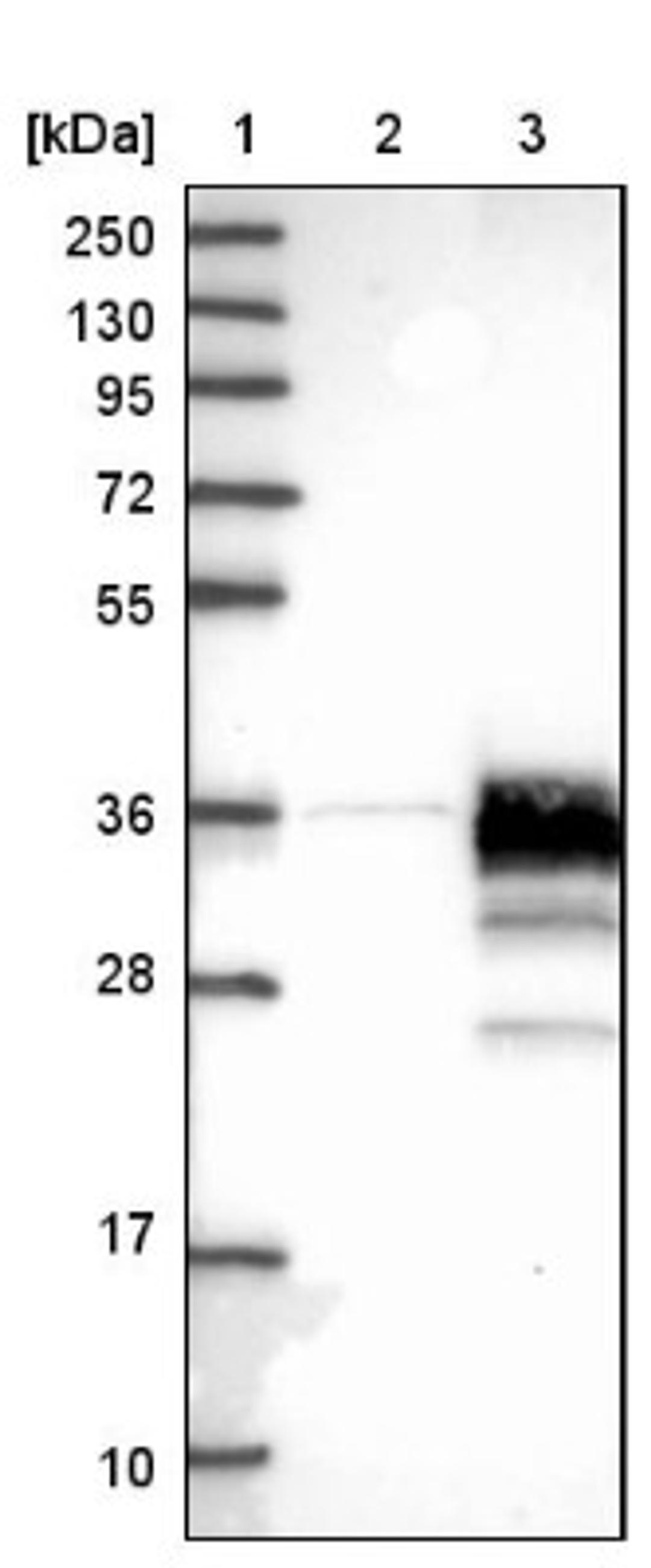 Western Blot: STARD3NL Antibody [NBP1-93527] - Lane 1: Marker [kDa] 250, 130, 95, 72, 55, 36, 28, 17, 10<br/>Lane 2: Negative control (vector only transfected HEK293T lysate)<br/>Lane 3: Over-expression lysate (Co-expressed with a C-terminal myc-DDK tag (~3.1 kDa) in mammalian HEK293T cells, LY410394)