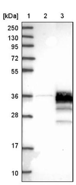 Western Blot: STARD3NL Antibody [NBP1-93527] - Lane 1: Marker [kDa] 250, 130, 95, 72, 55, 36, 28, 17, 10<br/>Lane 2: Negative control (vector only transfected HEK293T lysate)<br/>Lane 3: Over-expression lysate (Co-expressed with a C-terminal myc-DDK tag (~3.1 kDa) in mammalian HEK293T cells, LY410394)