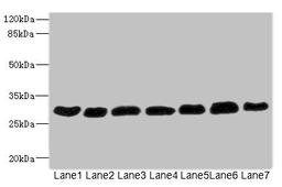 Western blot. All lanes: PGAM2 antibody at 7.28µg/ml. Lane 1: Rat heart tissue. Lane 2: Mouse skeletal muscle tissue. Lane 3: Hela whole cell lysate. Lane 4: HepG2 whole cell lysate. Lane 5: Jurkat whole cell lysate. Lane 6: MCF-7 whole cell lysate. Lane 7: U87 whole cell lysate. Secondary. Goat polyclonal to rabbit IgG at 1/10000 dilution. Predicted band size: 29 kDa. Observed band size: 29 kDa