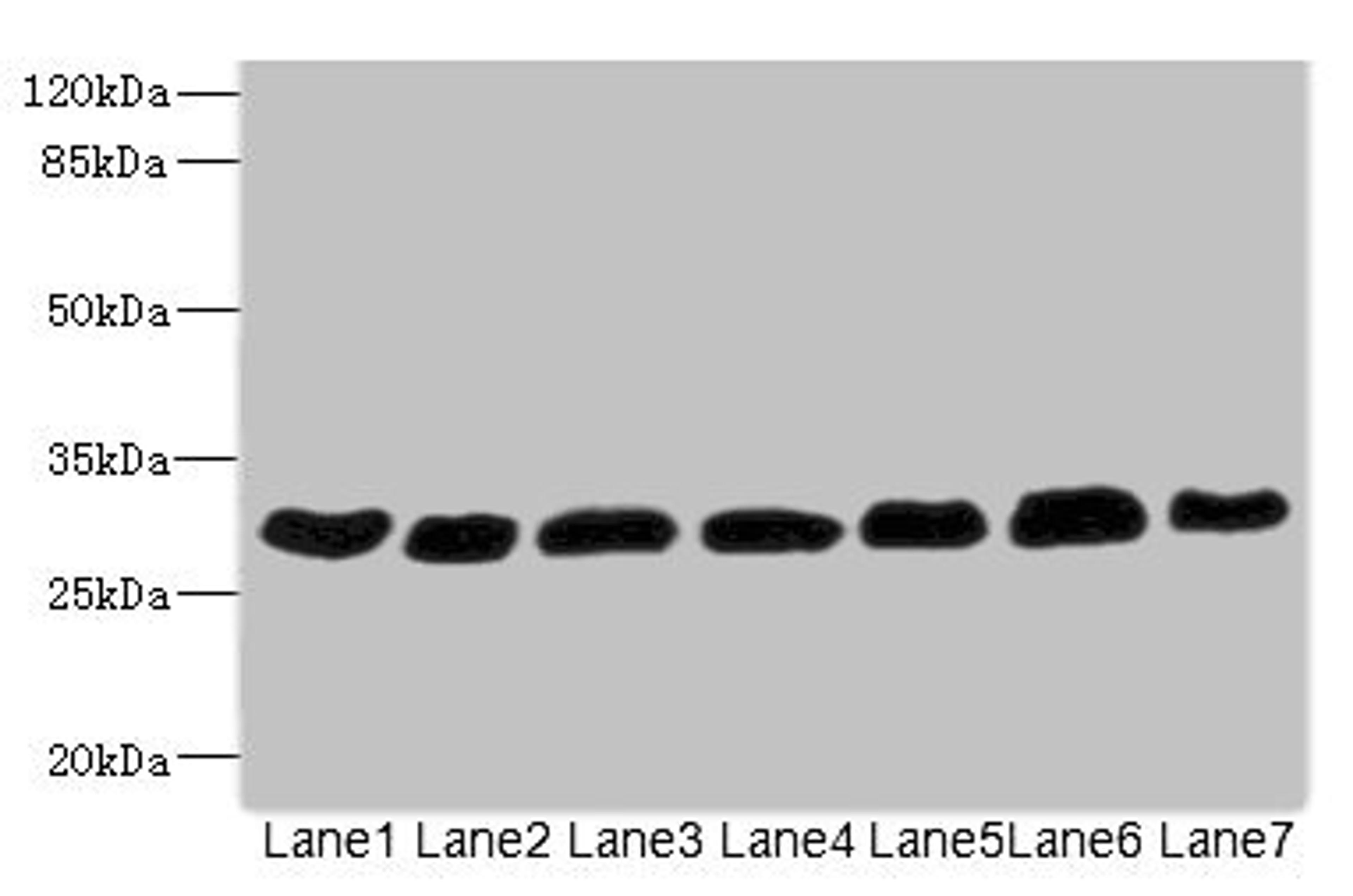 Western blot. All lanes: PGAM2 antibody at 7.28µg/ml. Lane 1: Rat heart tissue. Lane 2: Mouse skeletal muscle tissue. Lane 3: Hela whole cell lysate. Lane 4: HepG2 whole cell lysate. Lane 5: Jurkat whole cell lysate. Lane 6: MCF-7 whole cell lysate. Lane 7: U87 whole cell lysate. Secondary. Goat polyclonal to rabbit IgG at 1/10000 dilution. Predicted band size: 29 kDa. Observed band size: 29 kDa