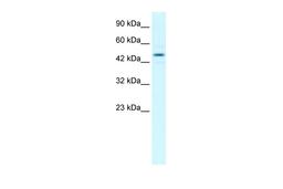 Antibody used in WB on Human Jurkat 1 ug/ml.