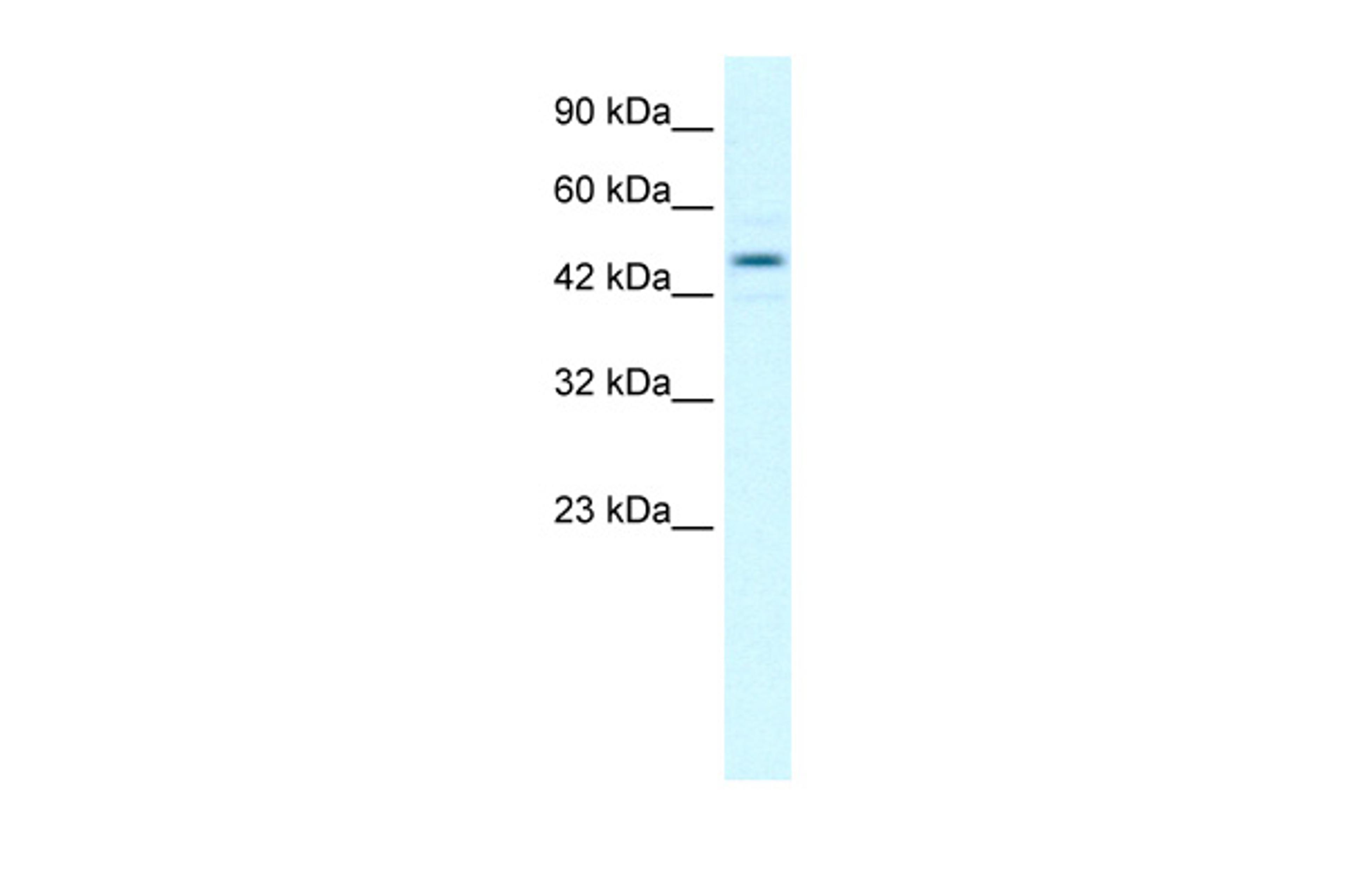 Antibody used in WB on Human Jurkat 1 ug/ml.