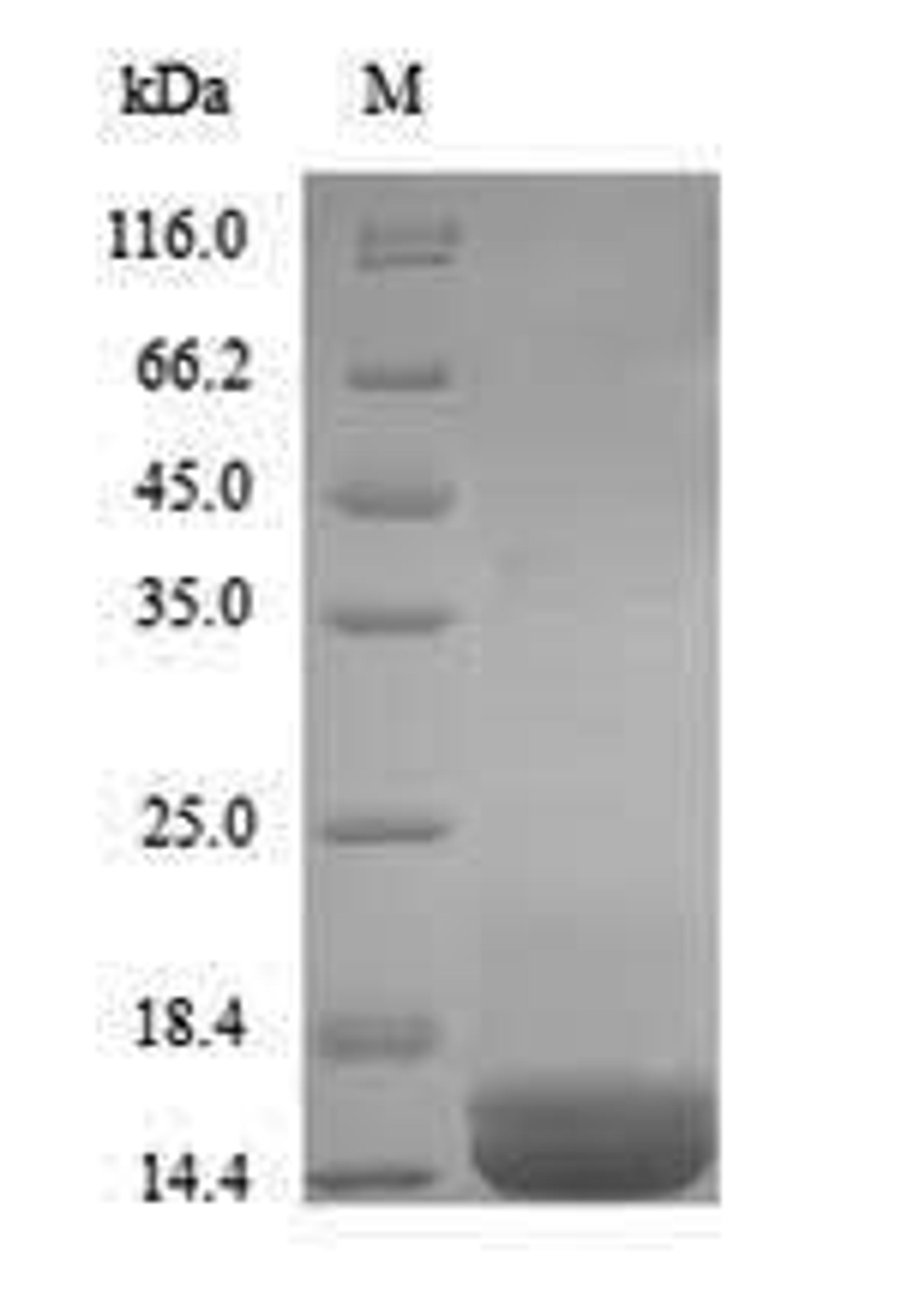 (Tris-Glycine gel) Discontinuous SDS-PAGE (reduced) with 5% enrichment gel and 15% separation gel.