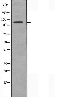 Western blot analysis of HepG2 cells using SHD antibody