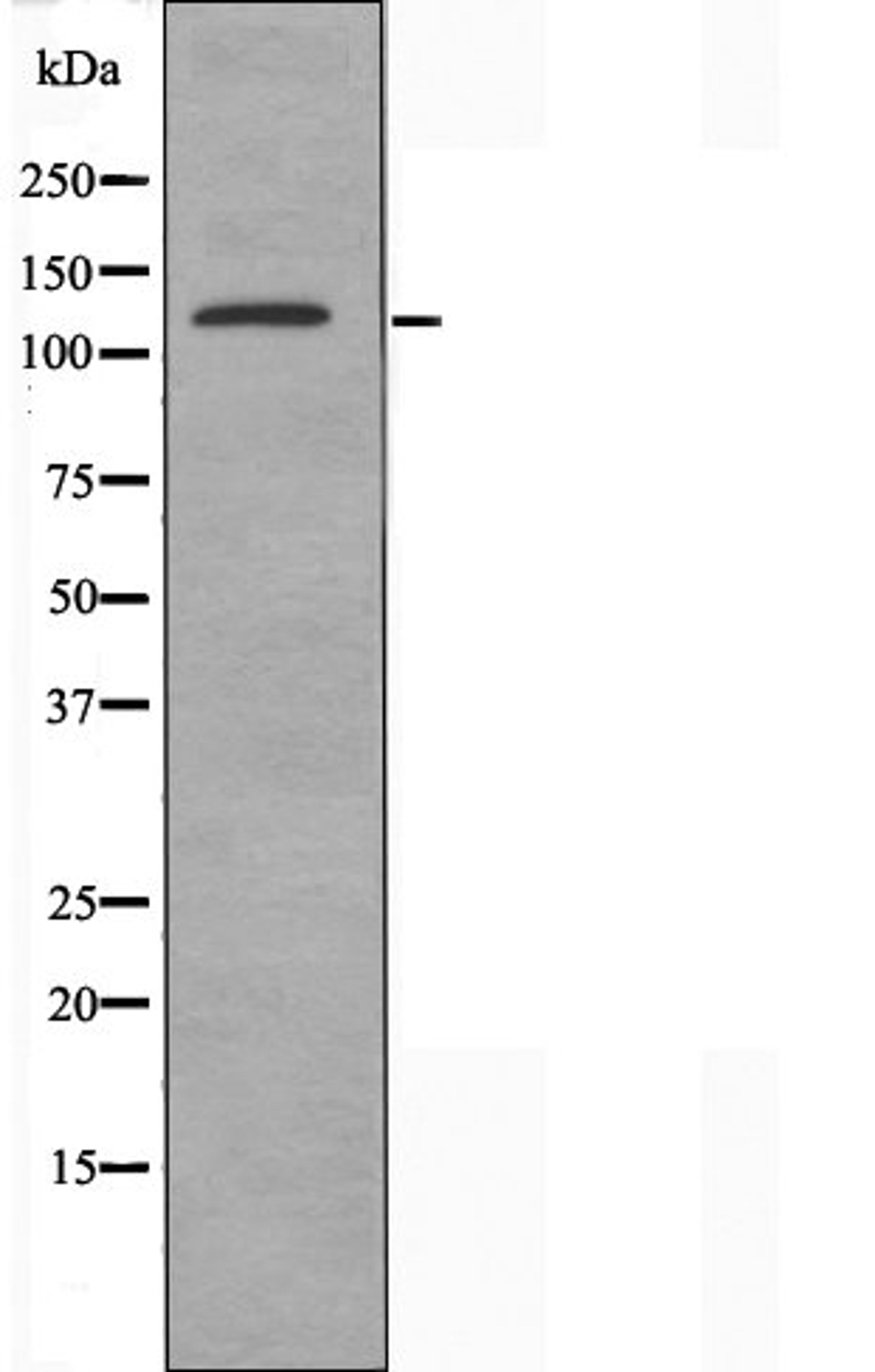 Western blot analysis of HepG2 cells using SHD antibody