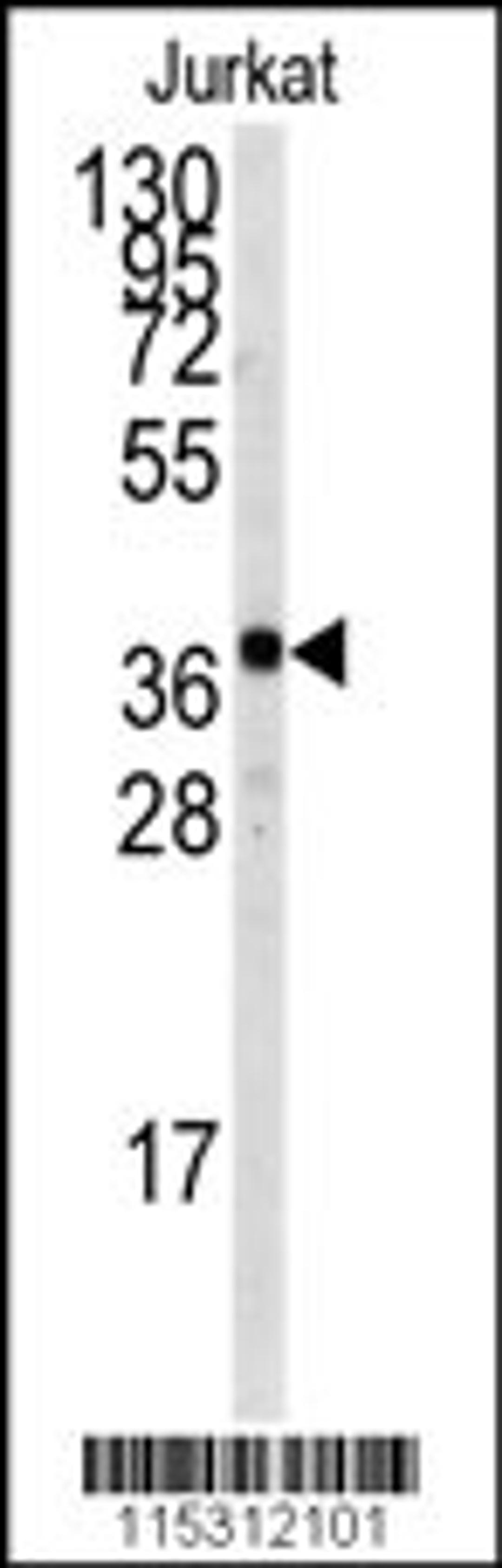 Western blot analysis of anti-TAL1 Antibody (T90) in Jurkat cell line lysates (35ug/lane)