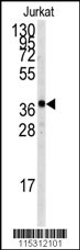 Western blot analysis of anti-TAL1 Antibody (T90) in Jurkat cell line lysates (35ug/lane)