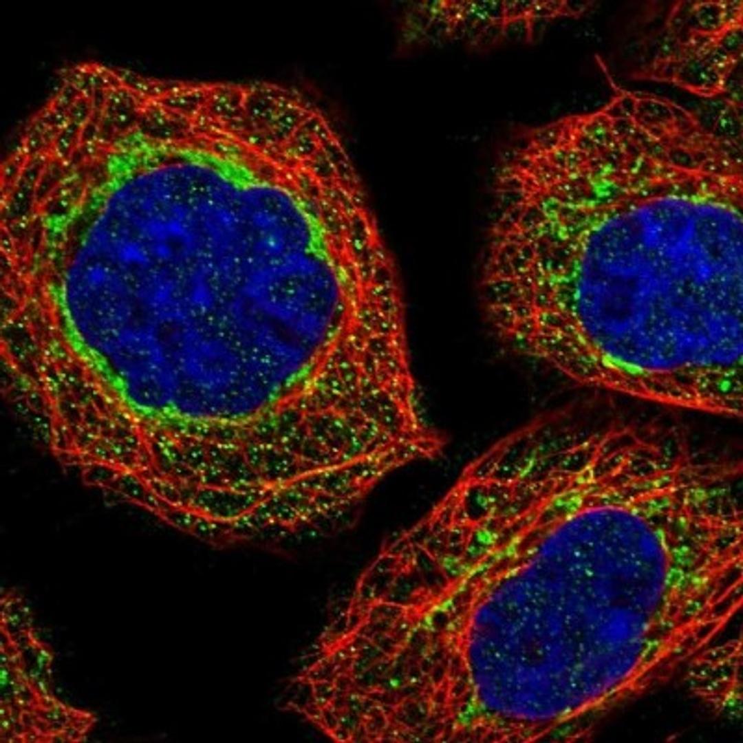 Immunocytochemistry/Immunofluorescence: USP25 Antibody [NBP1-80631] - Immunofluorescent staining of human cell line A-431 shows positivity in mitochondria.