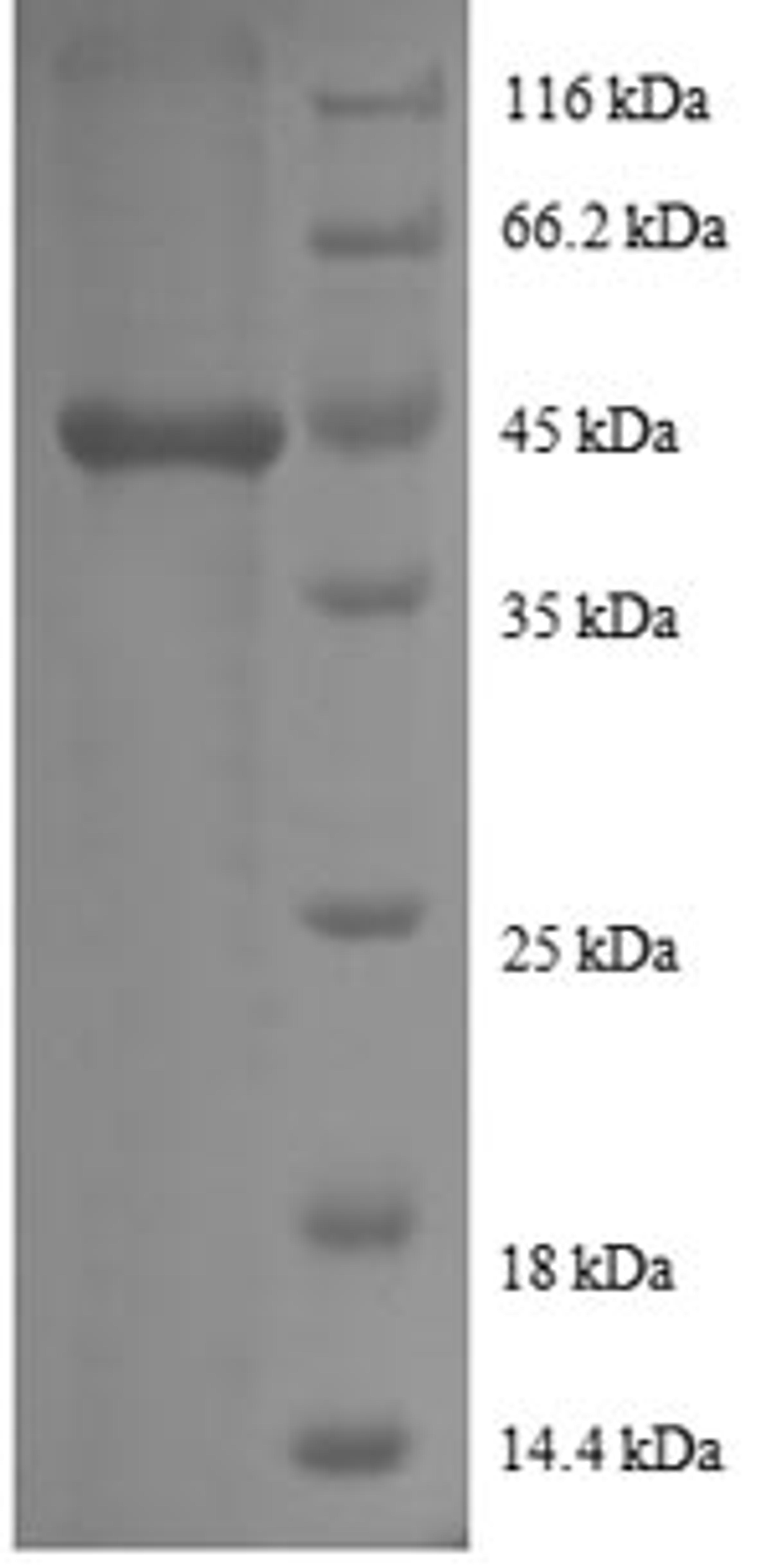 (Tris-Glycine gel) Discontinuous SDS-PAGE (reduced) with 5% enrichment gel and 15% separation gel.