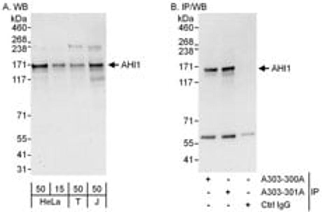 Detection of human AHI1 by western blot and immunoprecipitation.