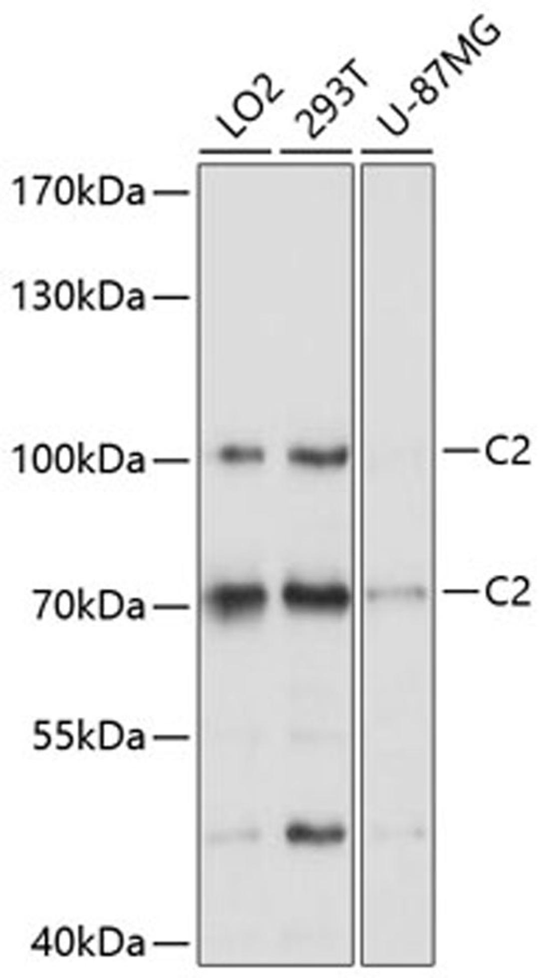 Western blot - C2 Antibody (A10186)