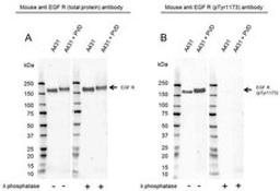 Western Blot analysis of A431 untreated and pervanadate treated whole cell lysates