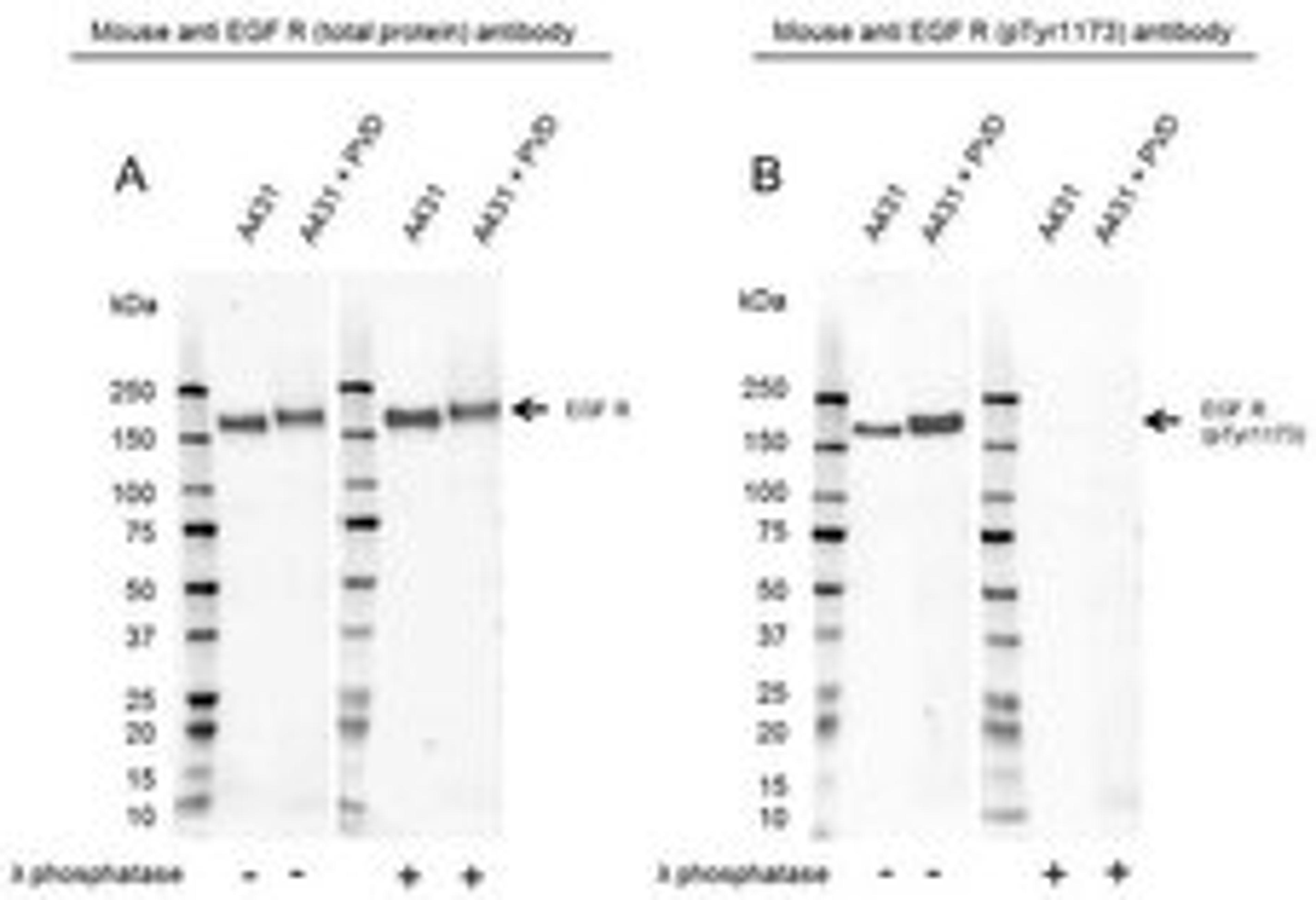 Western Blot analysis of A431 untreated and pervanadate treated whole cell lysates