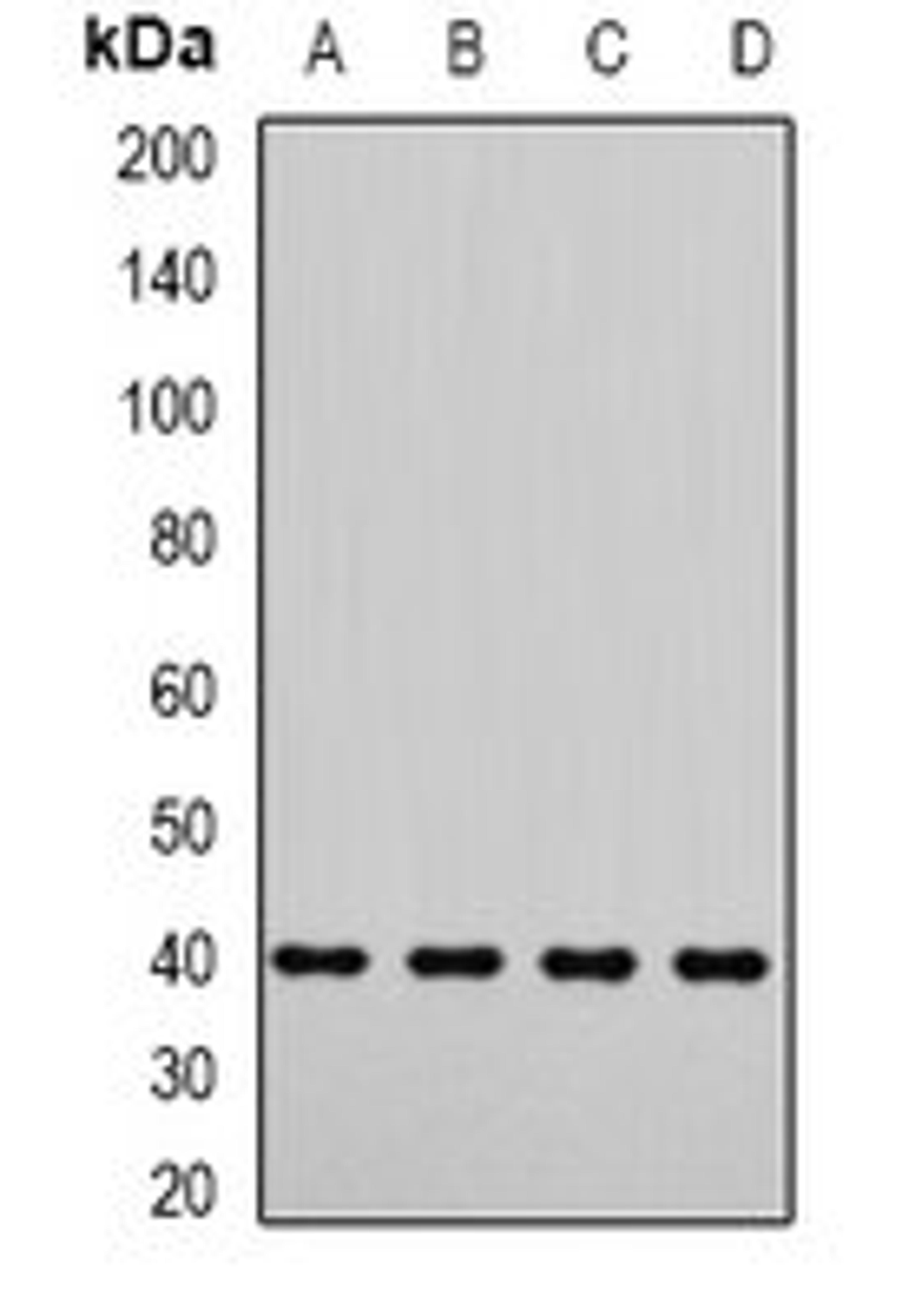 Western blot analysis of Jurkat (Lane1), A549 (Lane2), mouse testis (Lane3), rat testis (Lane4) whole cell lysates using DYNC2LI1 antibody