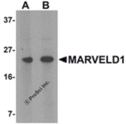 Western blot analysis of MARVELD1 in mouse heart tissue lysate with MARVELD1 antibody at (A) 1 and (B) 2 μg/mL.