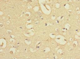 Immunohistochemistry of paraffin-embedded human brain tissue using CSB-PA007865LA01HU at dilution of 1:100