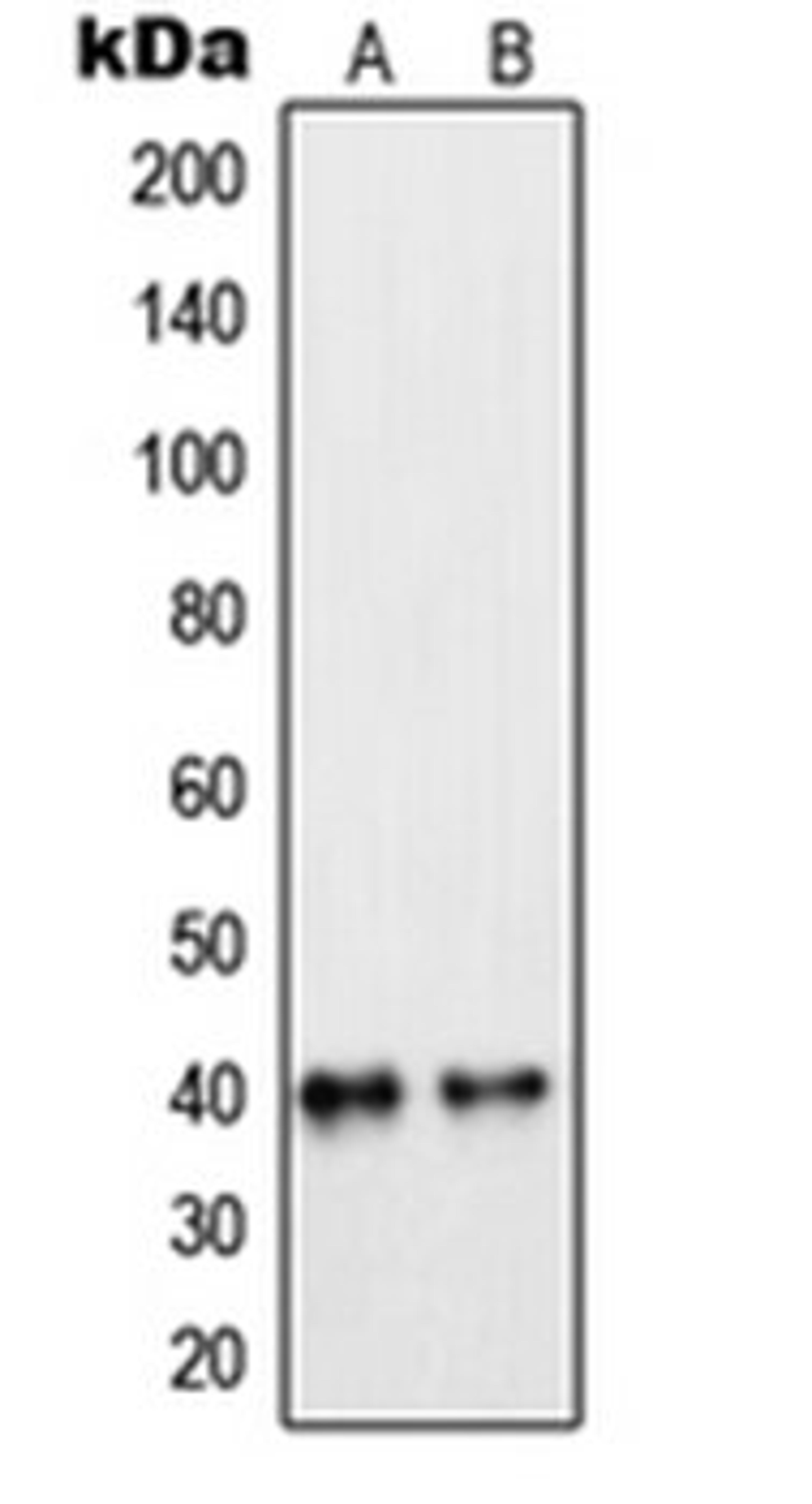 Western blot analysis of MCF7 (Lane 1), Raw264.7 (Lane 2) whole cell lysates using PEX7 antibody