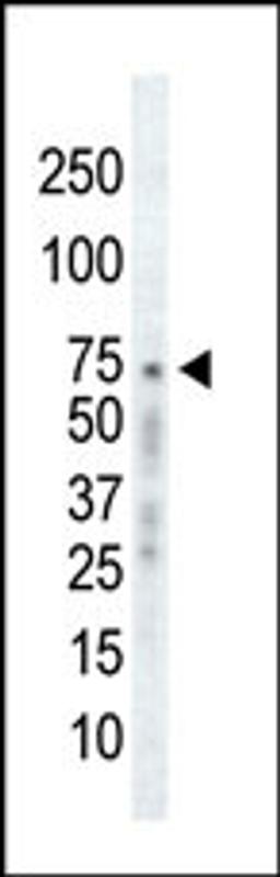 Western blot analysis of anti-GRK2 C-term Pab in Ramos cell lysate