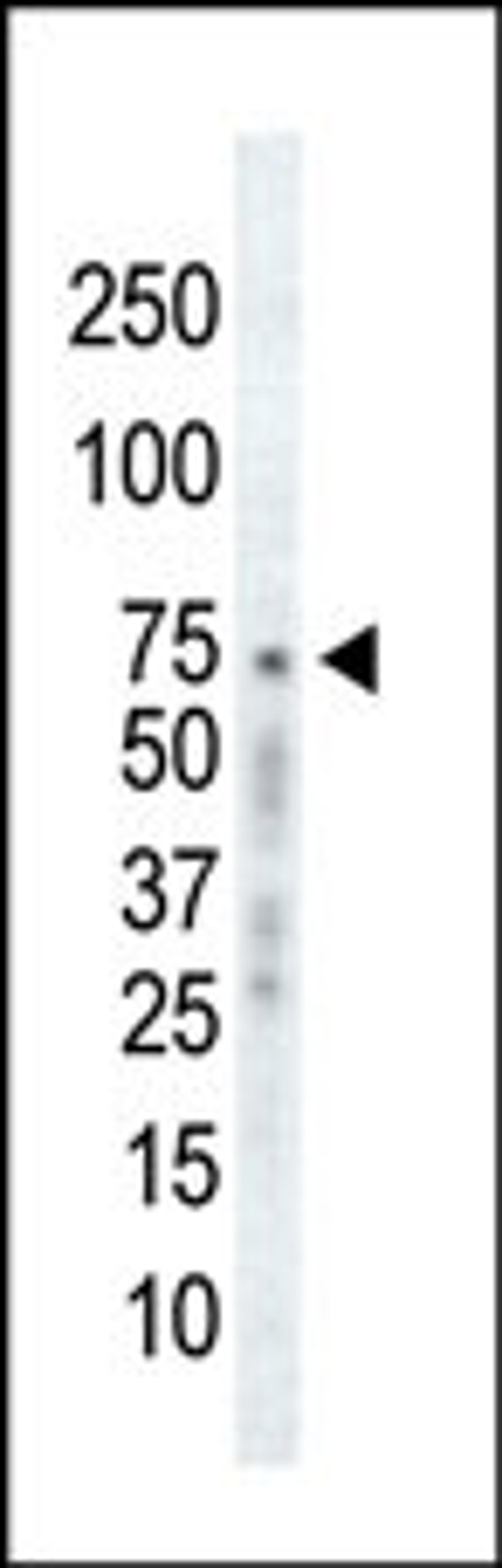 Western blot analysis of anti-GRK2 C-term Pab in Ramos cell lysate