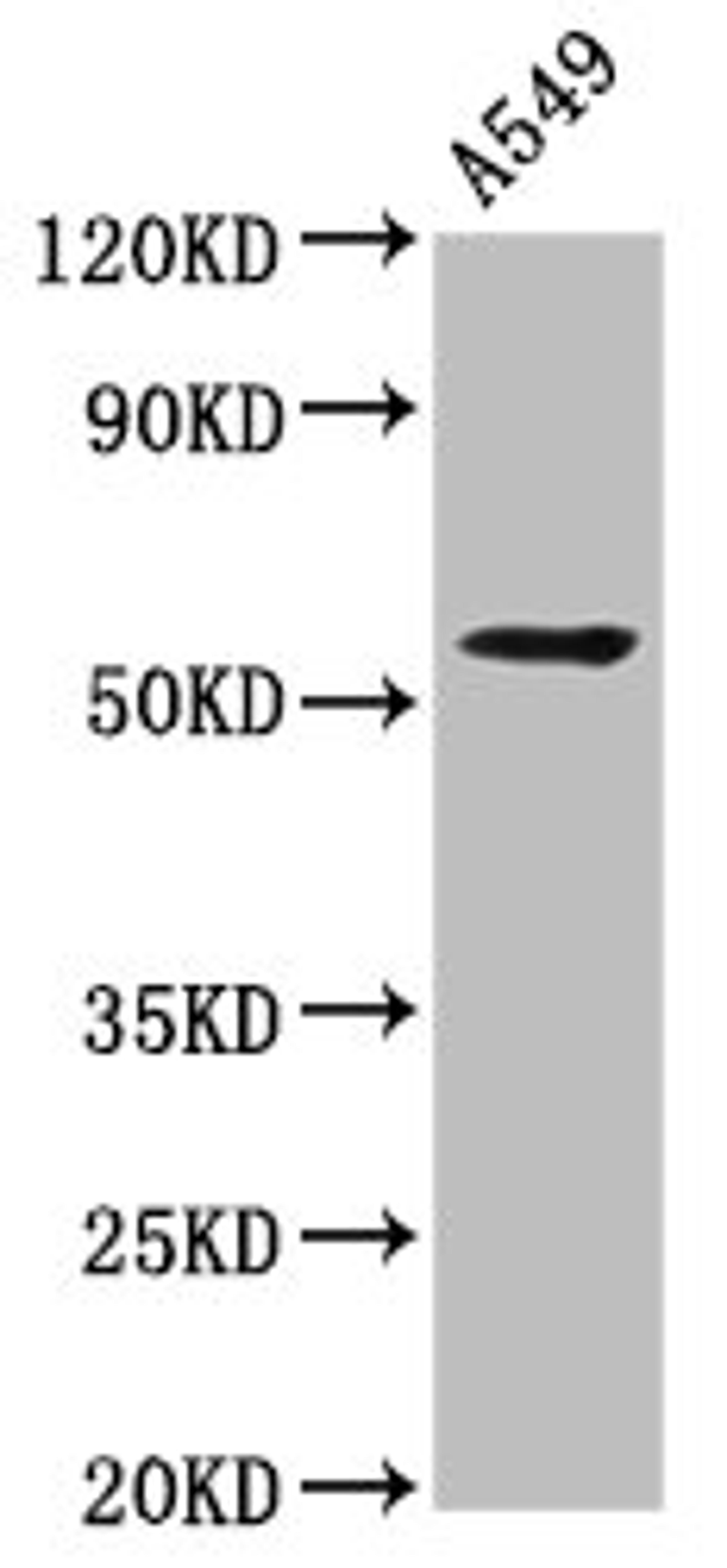 Western Blot. Positive WB detected in: A549 whole cell lysate. All lanes: THEMIS2 antibody at 4.2µg/ml. Secondary. Goat polyclonal to rabbit IgG at 1/50000 dilution. Predicted band size: 73, 30, 57, 14, 58, 51 kDa. Observed band size: 57 kDa