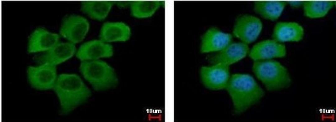 Immunocytochemistry/Immunofluorescence: Semaphorin 6A Antibody [NBP1-31551] - [N2C1], Internal detects SEMA6A protein at cytoplasm by immunofluorescent analysis. Sample: A431 cells were fixed in 4% paraformaldehyde at RT for 15 min.Green: SEMA6A protein stained by SEMA6A antibody [N2C1], Diluted at 1:500.Blue: Hoechst 33342 staining.