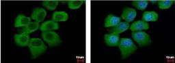 Immunocytochemistry/Immunofluorescence: Semaphorin 6A Antibody [NBP1-31551] - [N2C1], Internal detects SEMA6A protein at cytoplasm by immunofluorescent analysis. Sample: A431 cells were fixed in 4% paraformaldehyde at RT for 15 min.Green: SEMA6A protein stained by SEMA6A antibody [N2C1], Diluted at 1:500.Blue: Hoechst 33342 staining.