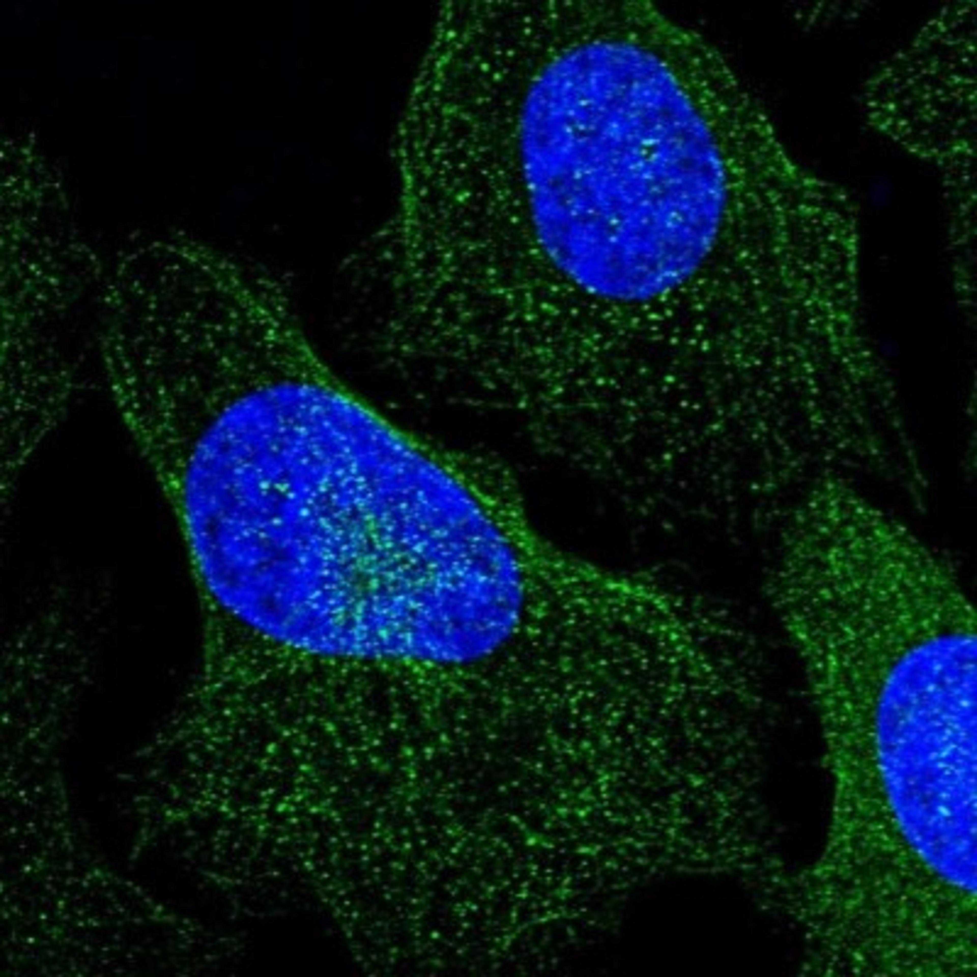 Immunocytochemistry/Immunofluorescence: RHOBTB1 Antibody [NBP1-81485] - Staining of human cell line U-2 OS shows positivity in cytoplasm & cytoskeleton (microtubules).