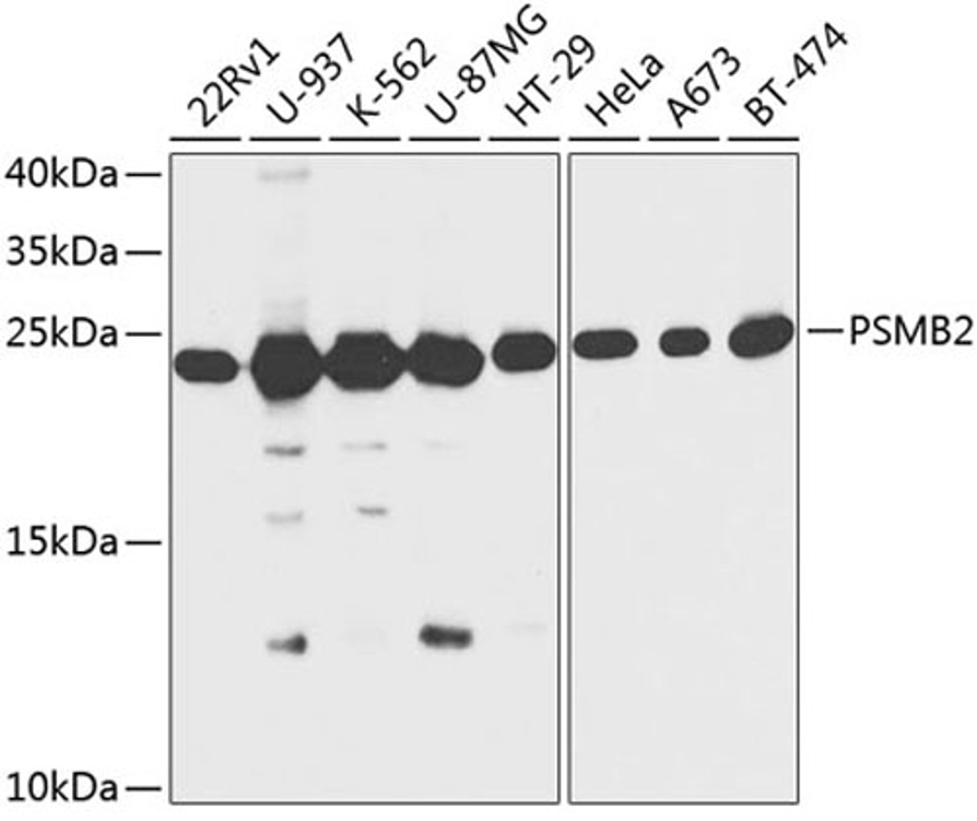 Western blot - PSMB2 antibody (A13630)