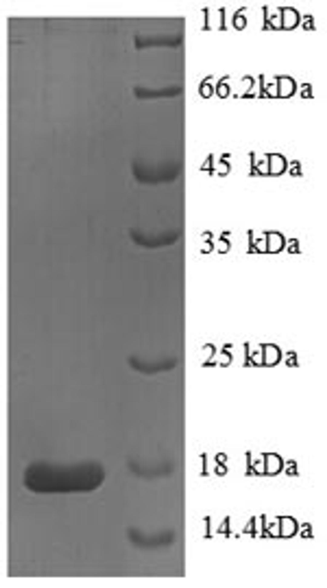 (Tris-Glycine gel) Discontinuous SDS-PAGE (reduced) with 5% enrichment gel and 15% separation gel.