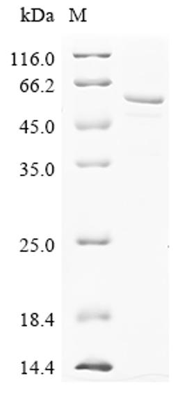 (Tris-Glycine gel) Discontinuous SDS-PAGE (reduced) with 5% enrichment gel and 15% separation gel.