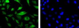 Immunocytochemistry/Immunofluorescence: Mre11 Antibody [NB100-142] - Detection of MRE11 (Green) in Hela cells using NB100-142 at a 1:200 dilution. Nuclei (Blue) are counterstained using Hoechst 33258.