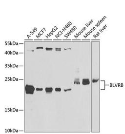 Western blot - BLVRB antibody (A7260)