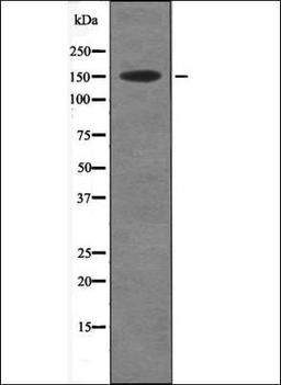 Western blot analysis of Insulin treated HT29 whole cell lysates using Acinus -Phospho-Ser1180- antibody