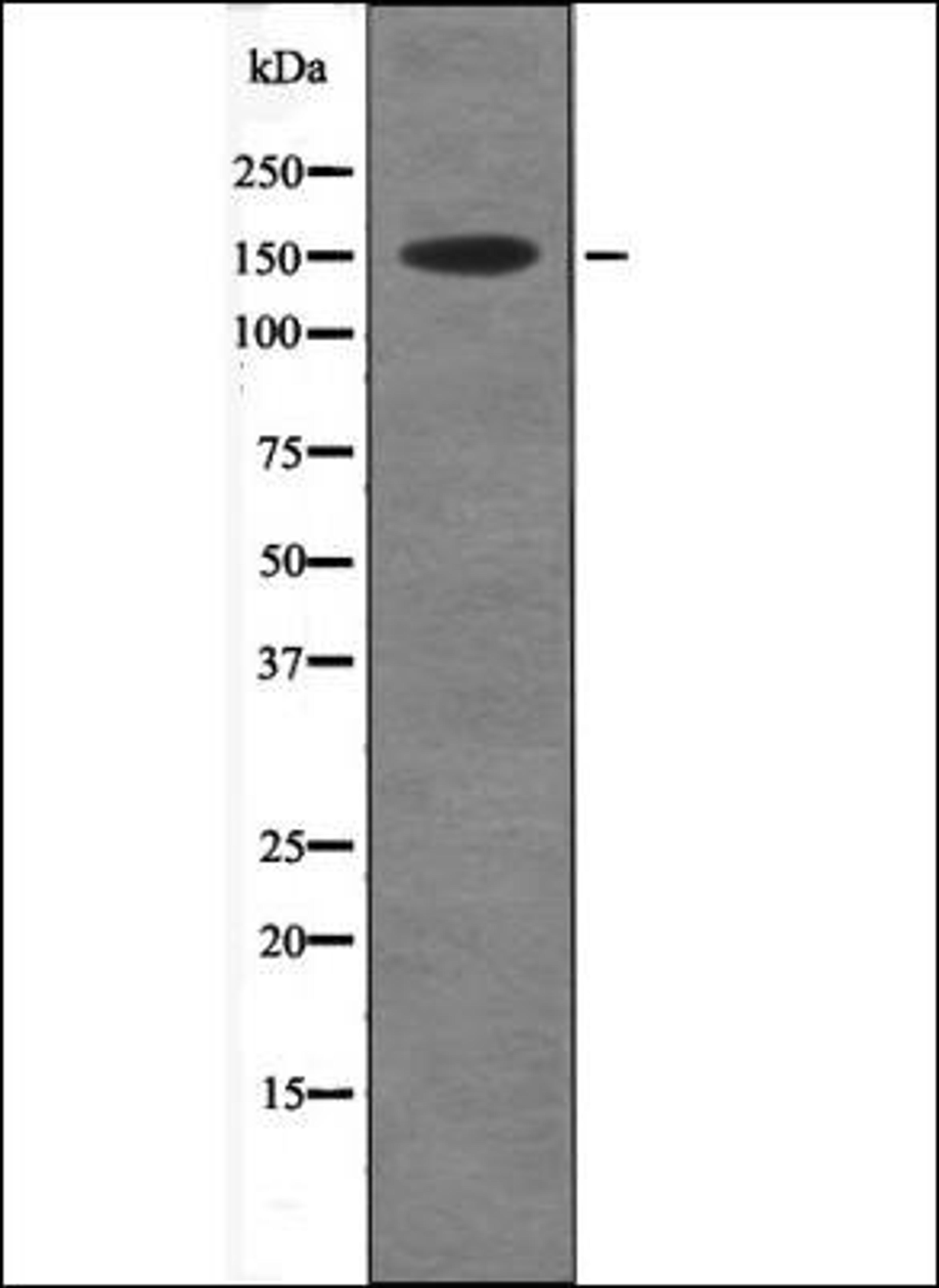 Western blot analysis of Insulin treated HT29 whole cell lysates using Acinus -Phospho-Ser1180- antibody