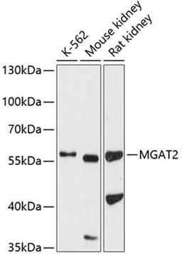 Western blot - MGAT2 antibody (A9134)