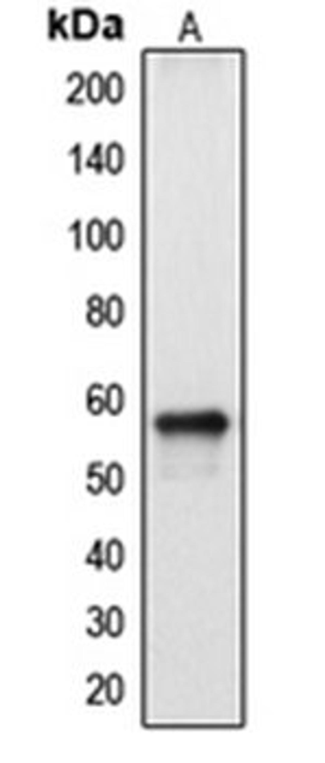 Western blot analysis of HepG2 (Lane 1) whole cell lysates using CYP2A13 antibody