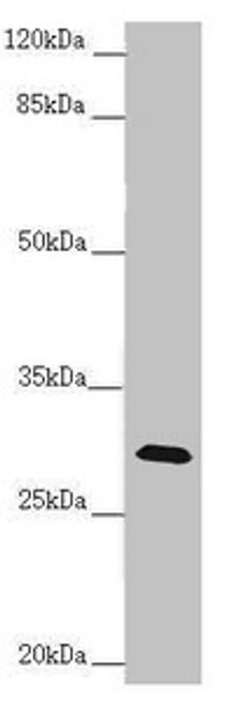 Western blot. All lanes: CENPH antibody at 1.61 ug/ml + Mouse lung tissue. Secondary. Goat polyclonal to rabbit IgG at 1/10000 dilution. Predicted band size: 28 kDa. Observed band size: 28 kDa. 