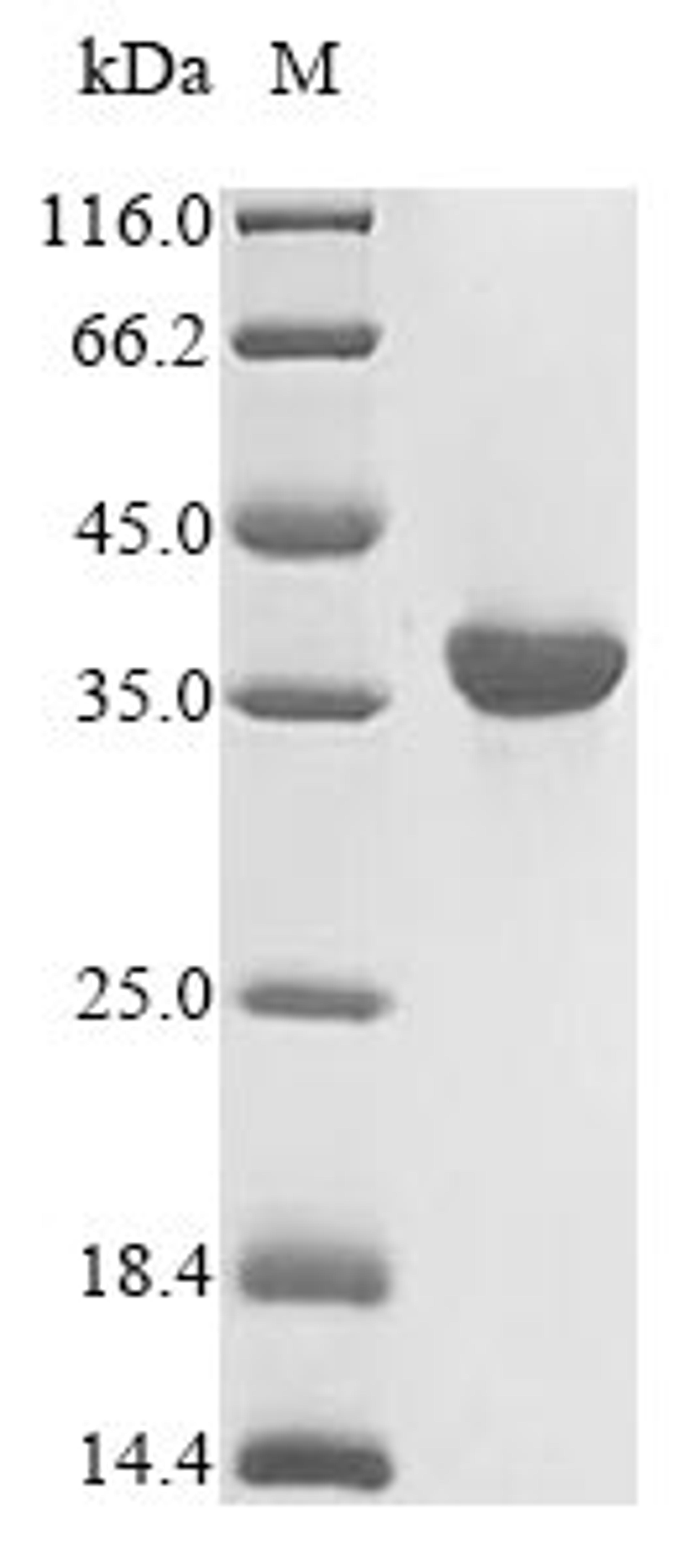 (Tris-Glycine gel) Discontinuous SDS-PAGE (reduced) with 5% enrichment gel and 15% separation gel.