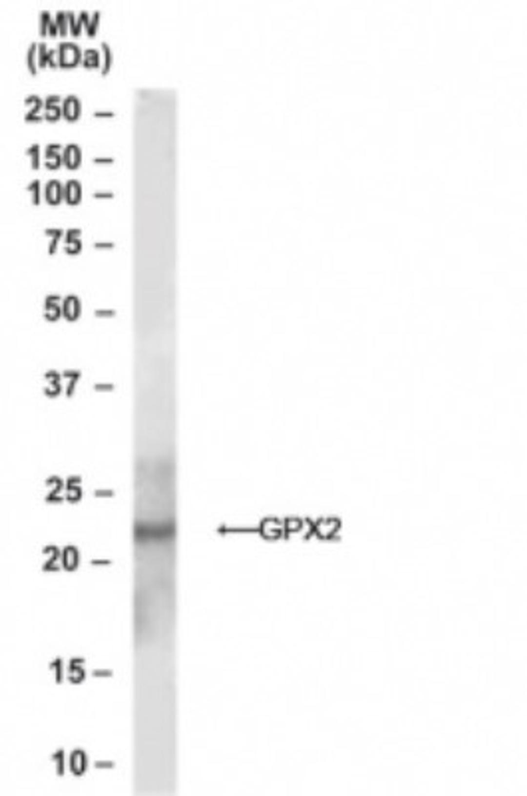 Western Blot: Glutathione Peroxidase 2 Antibody [NB100-1888] - Analysis of Glutathione Peroxidase 2 in Human Prostate lysate using NB100-1888 at 1ug/ml.