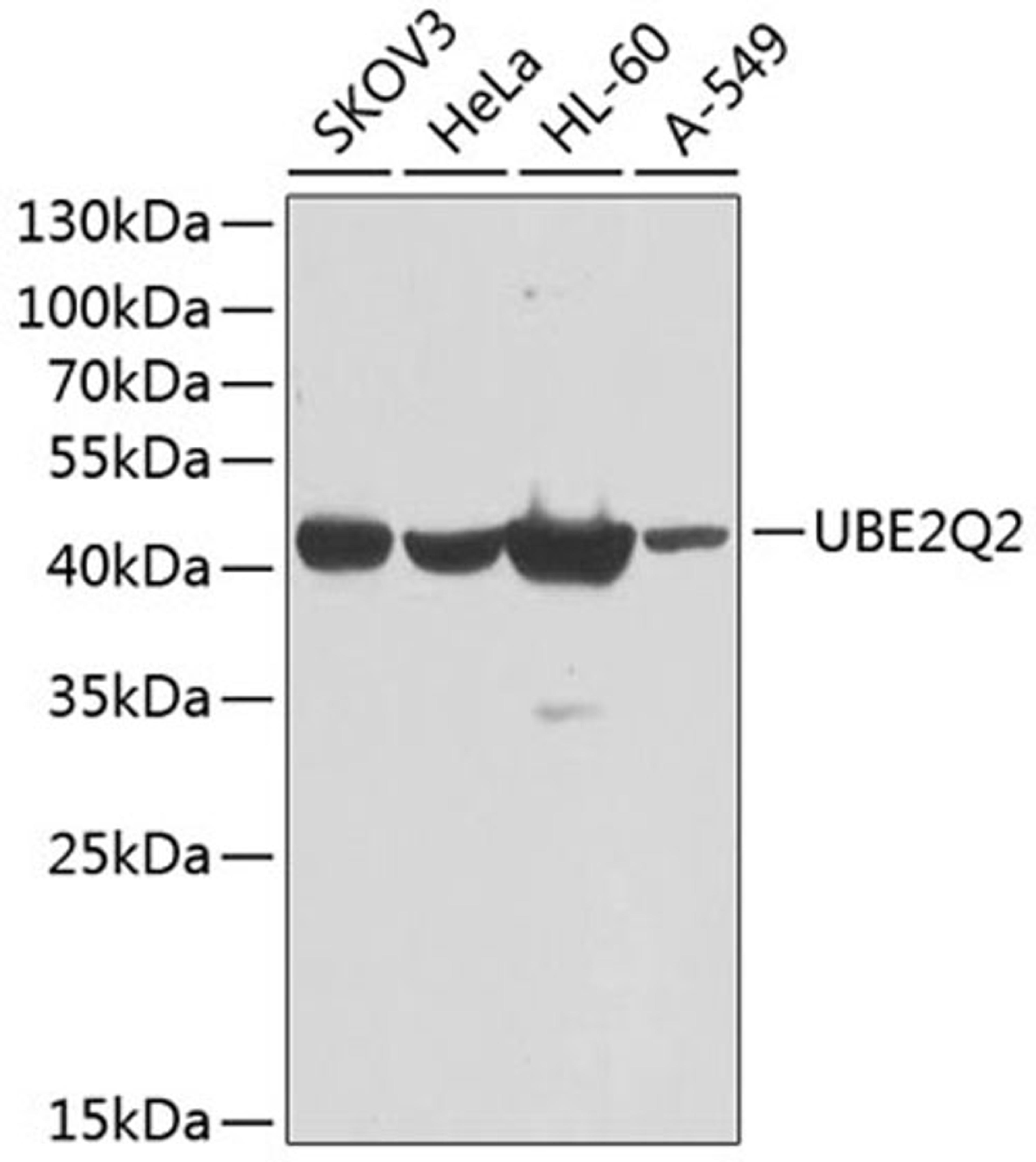 Western blot - UBE2Q2 antibody (A9992)