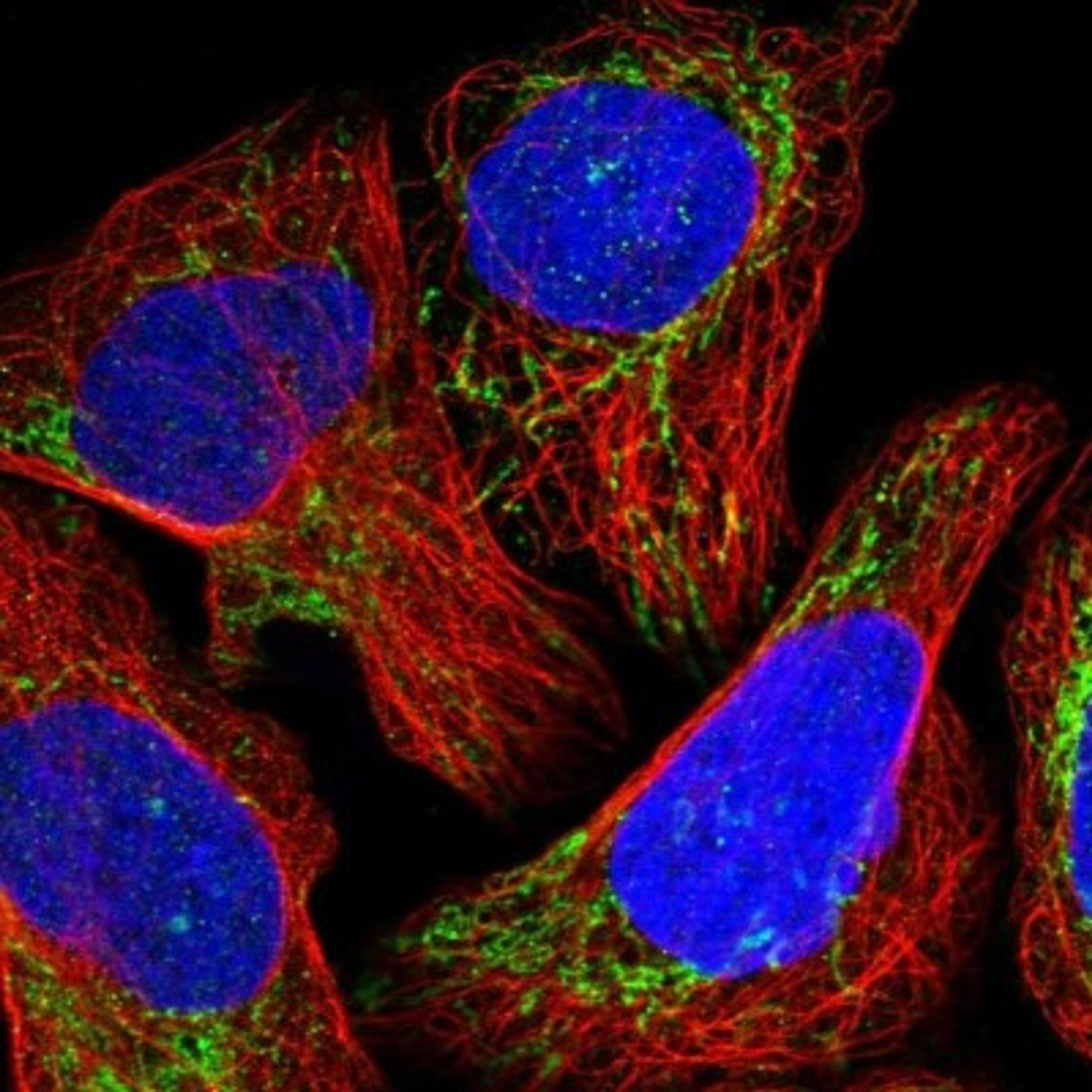 Immunofluorescence: NDUFB11 Antibody [NBP1-83956] - Staining of human cell line U-2 OS shows positivity in mitochondria.