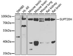 Western blot - SUPT20H antibody (A7374)