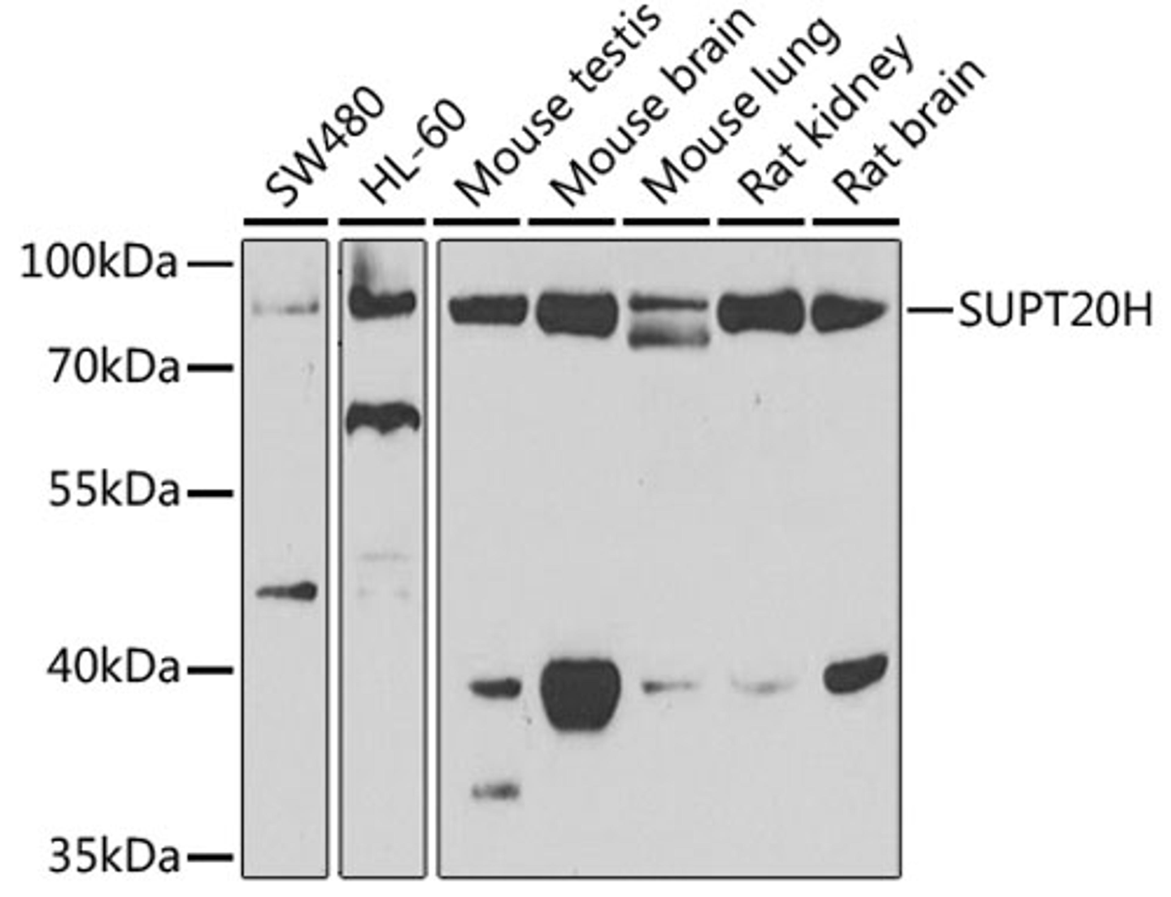 Western blot - SUPT20H antibody (A7374)