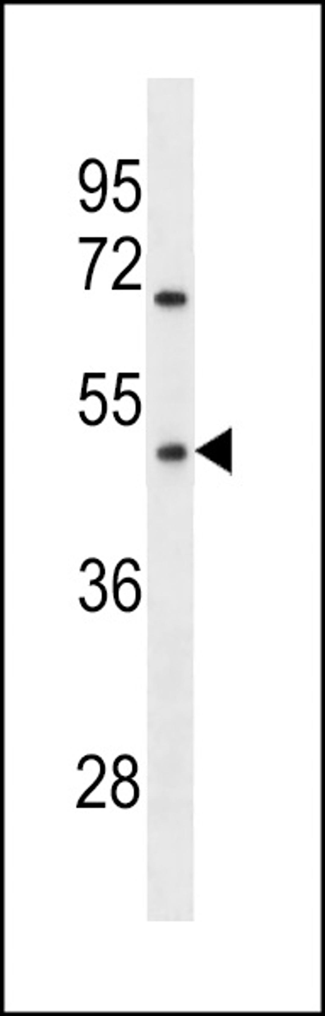 Western blot analysis in MDA-MB231 cell line lysates (35ug/lane).