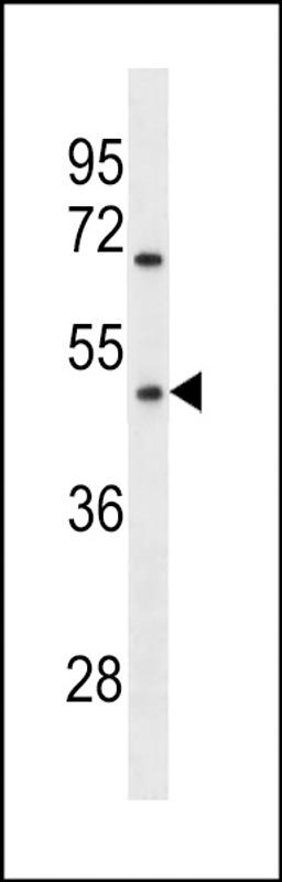 Western blot analysis in MDA-MB231 cell line lysates (35ug/lane).