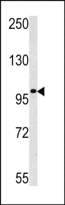 Western blot analysis of MAGEC1 antibody in K562 cell line lysates (35ug/lane)