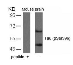 Western blot analysis of lysed extracts from mouse brain tissue using Tau (Phospho-Ser396).