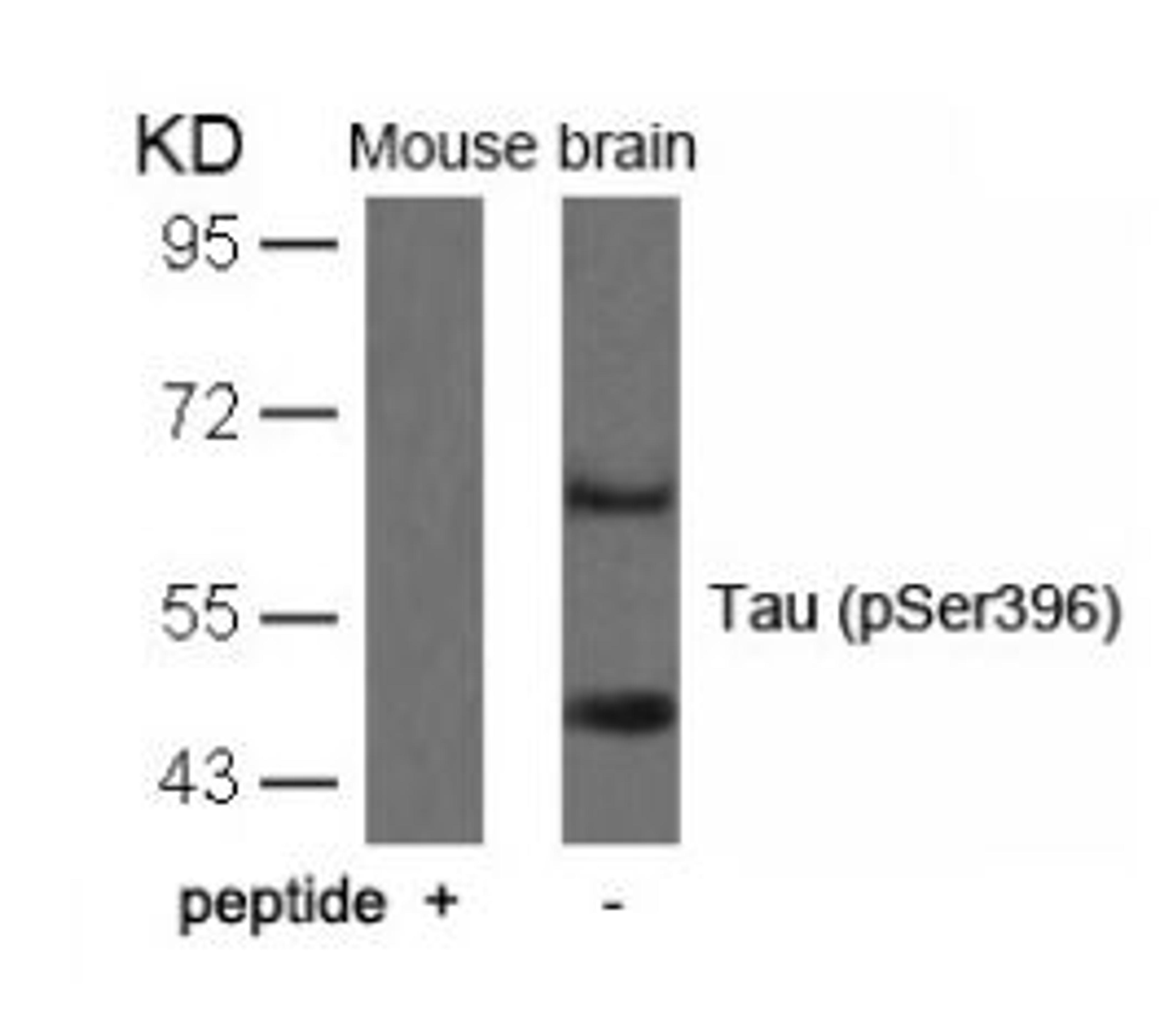 Western blot analysis of lysed extracts from mouse brain tissue using Tau (Phospho-Ser396).